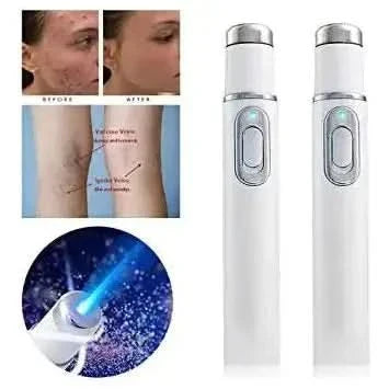 Light Therapy Acne Pen – Advanced LED Treatment for Clearer Skin - Glam Global UKGlam Global UK