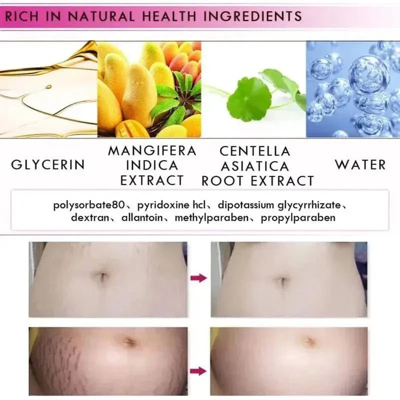RtopR Mango Stretch Mark Cream For Pregnancy Repair - 40g - Glam Global UKRtopR