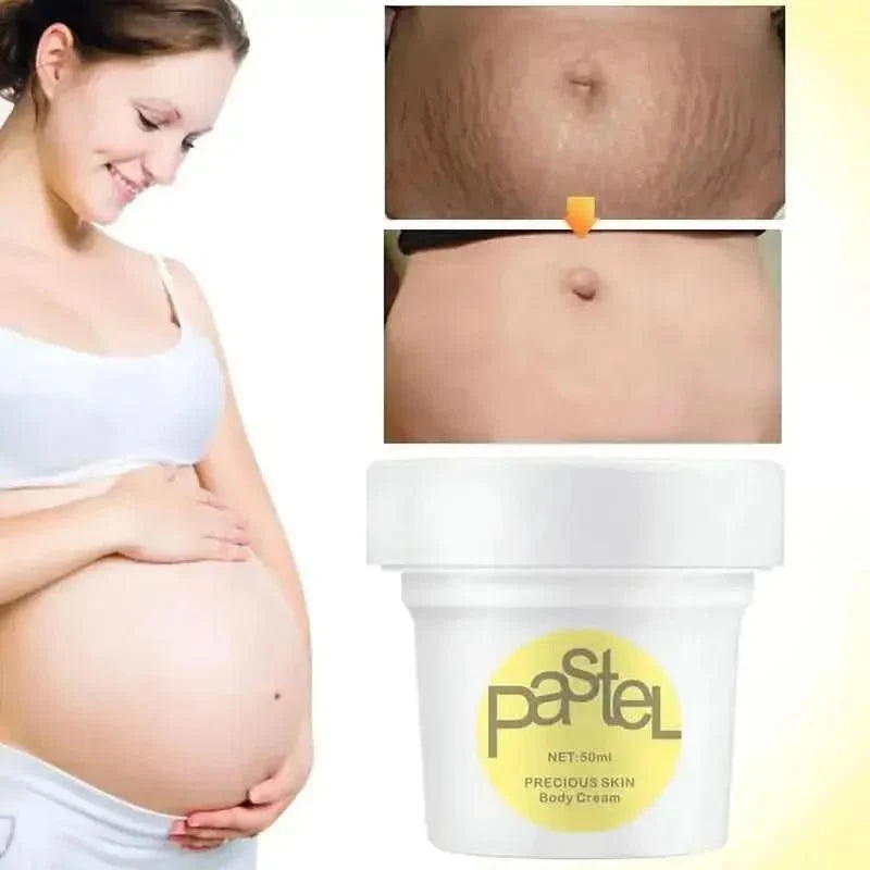 Pastel Maternity Stretch Marks Cream – Fade Stretch Marks & Nourish Skin - Glam Global UKPastel