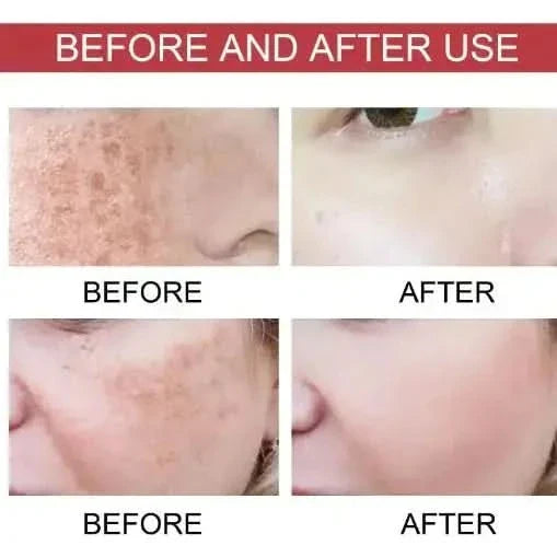 Monika Niacinamide Moisturizing Care Solution - 100ml - Glam Global UKGlam Global UK