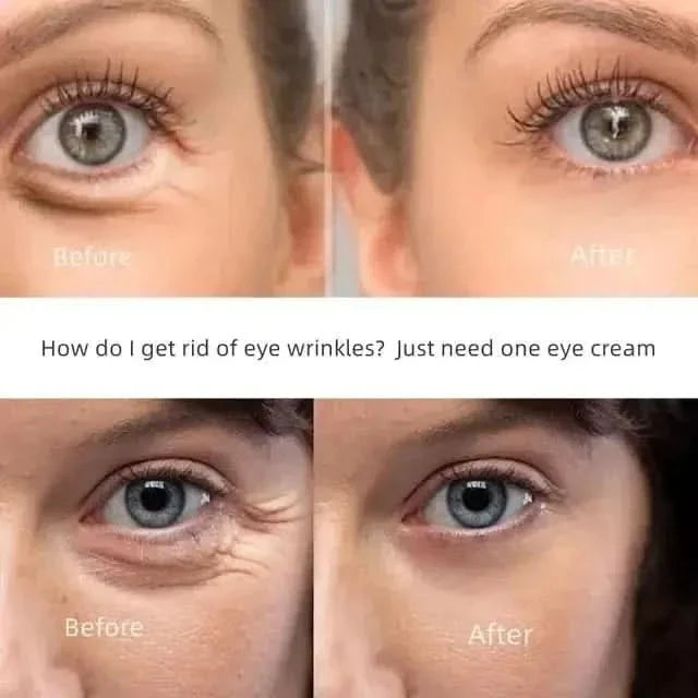 New Anti - Wrinkle Eye Cream - Glam Global UKGlam Global UK