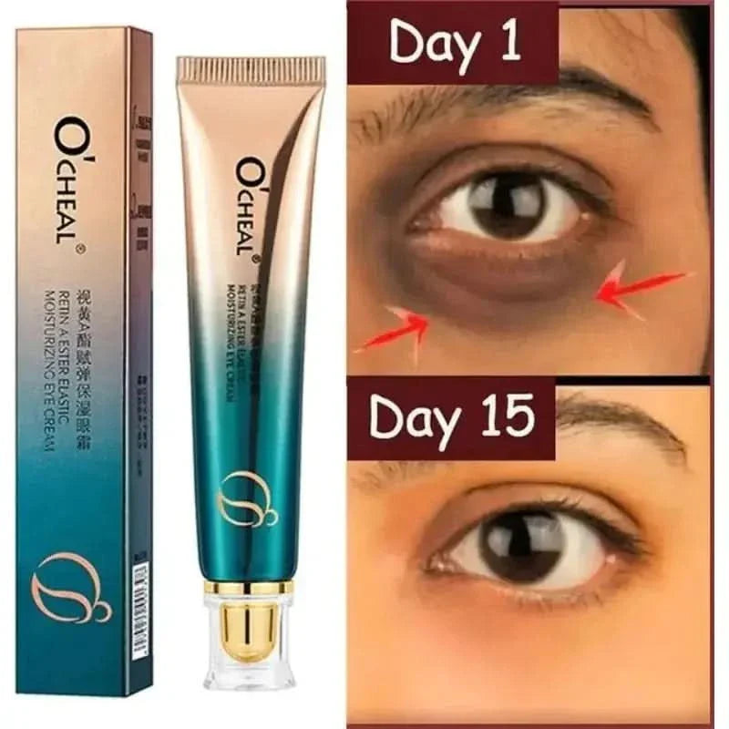 New Anti - Wrinkle Eye Cream - Glam Global UKGlam Global UK