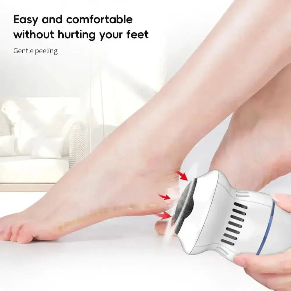 Portable Vacuum Callus Remover - Glam Global UKGlam Global UK