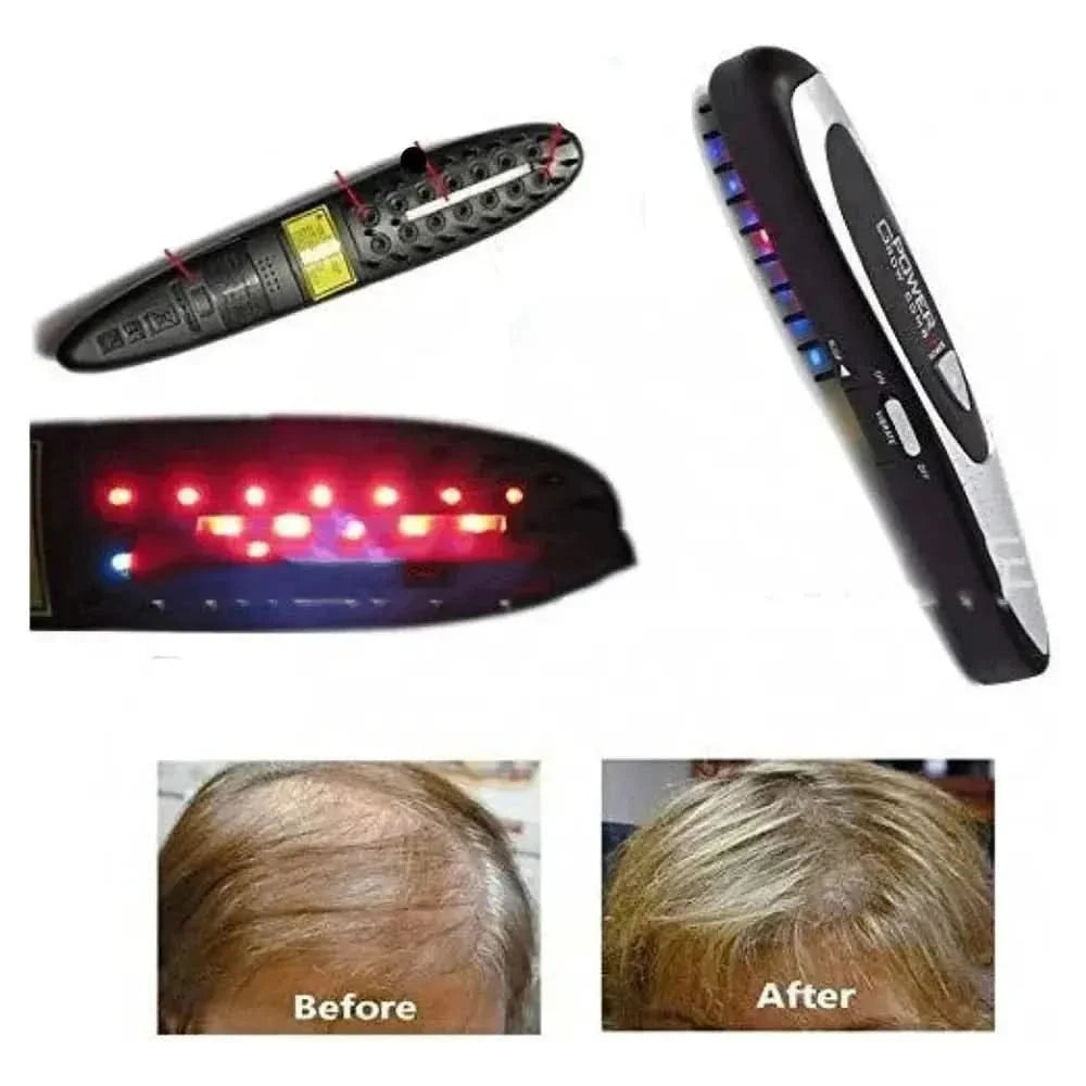Power Grow Comb | Electric Laser Treatment Comb for Hair Regeneration & Loss Prevention - Glam Global UKGlam Global UK