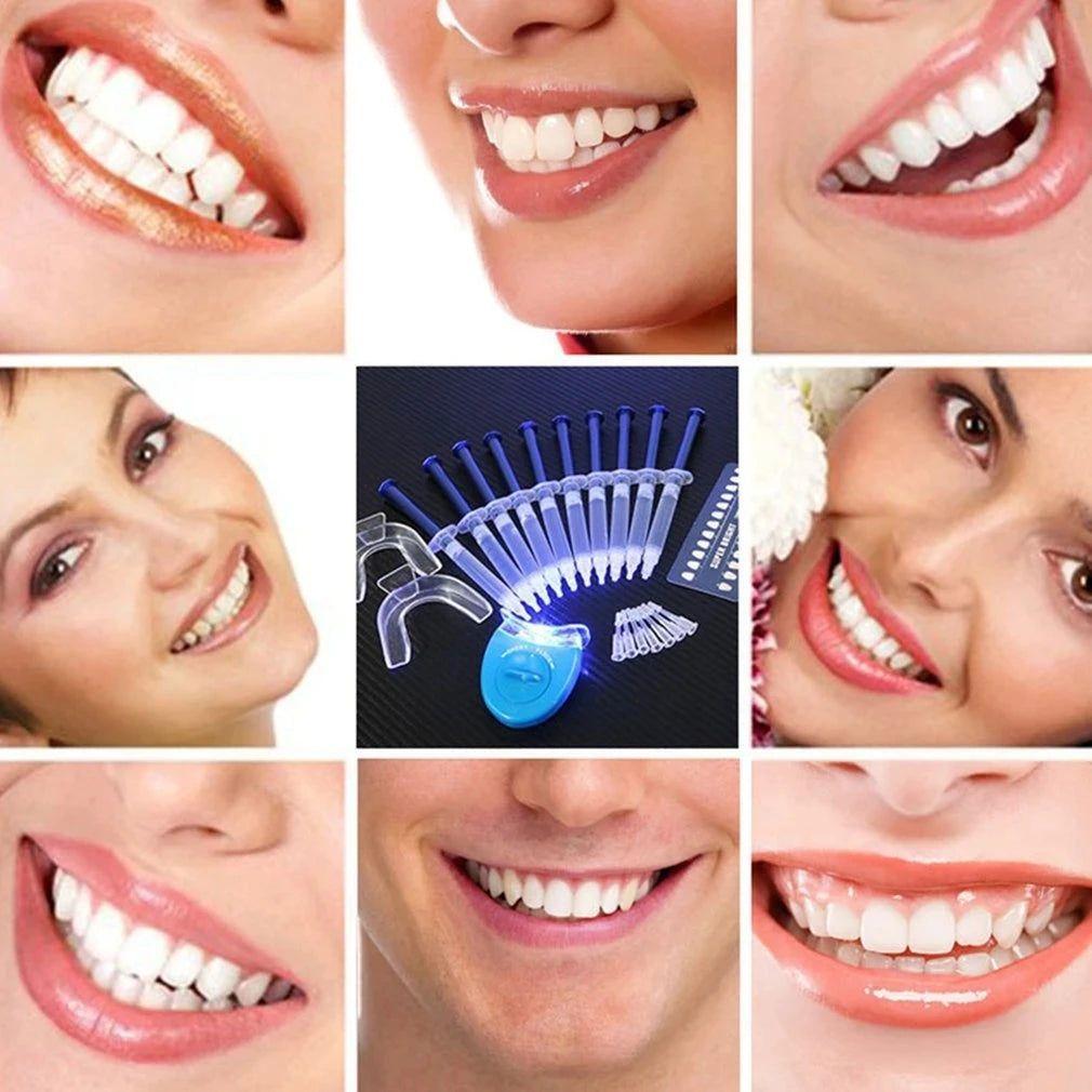 Professional Whitening Kit - Glam Global UKGlam Global UK