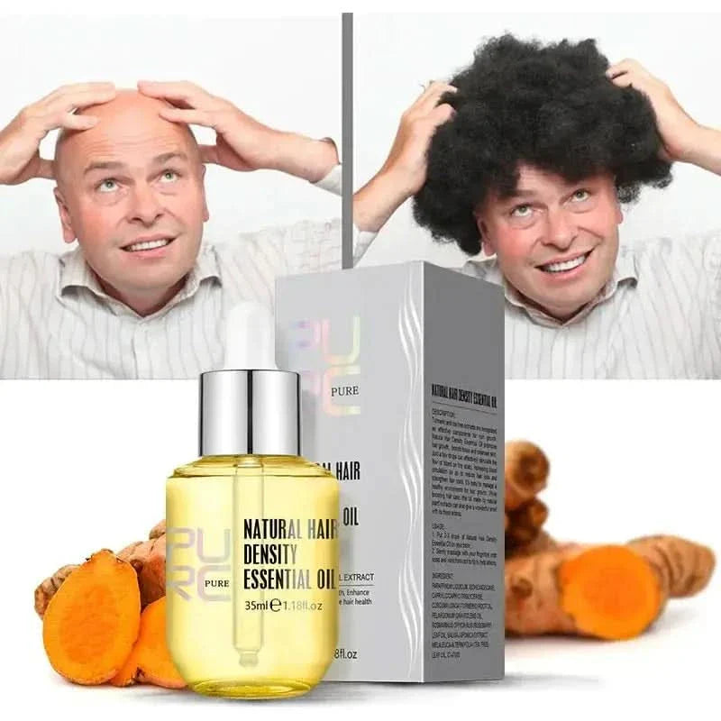 PURC Ginger Hair Growth Oil - Glam Global UKGlam Global UK