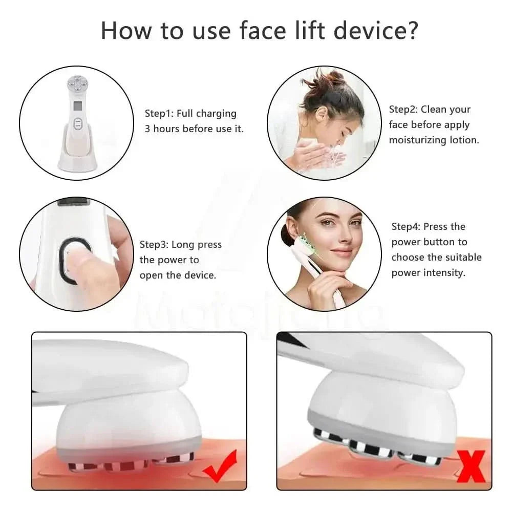 RF EMS LED Photon Facial Rejuvenation Device – Acne & Wrinkle Treatment - Glam Global UKGlam Global UK