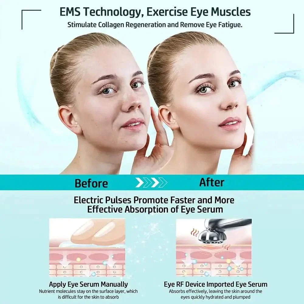 RF Microcurrent Device – Lift, Firm, and Rejuvenate for Youthful Skin - Glam Global UKGlam Global UK