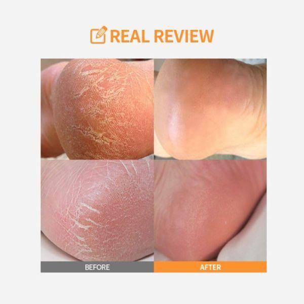 SUNGBOON EDITOR LHA Baby Foot Scrub Stick 20g - Glam Global UKSUNGBOON EDITOR