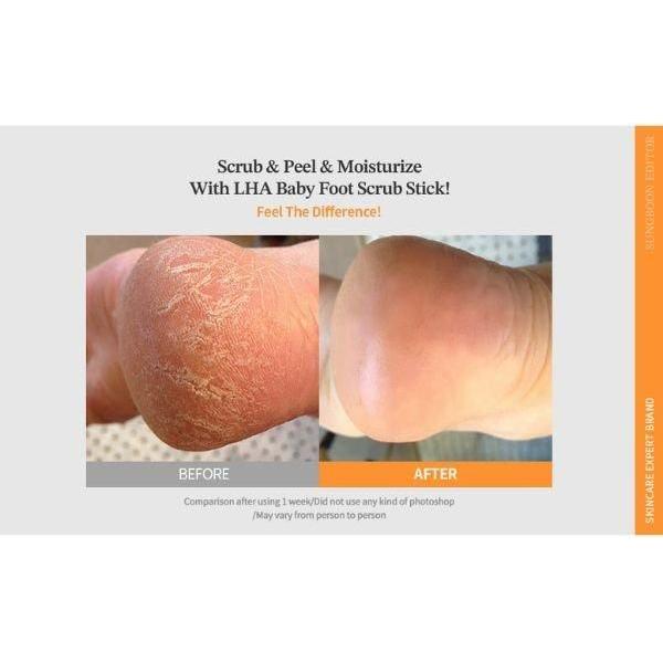 SUNGBOON EDITOR LHA Baby Foot Scrub Stick 20g - Glam Global UKSUNGBOON EDITOR