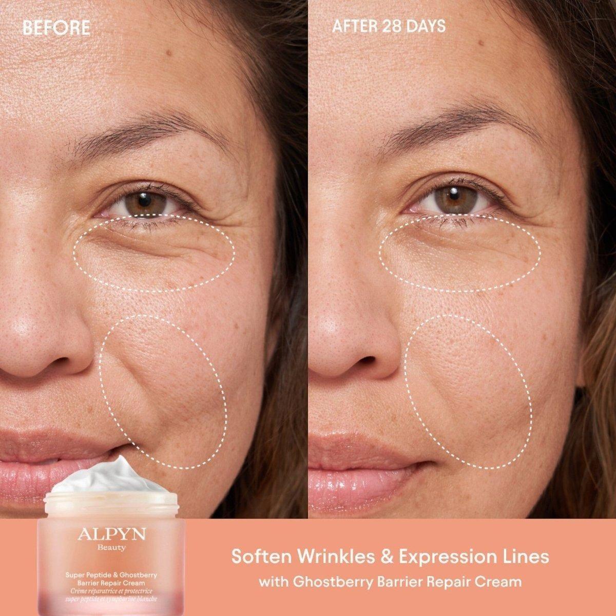 Alpyn Beauty Super Peptide and Ghostberry Barrier Repair Cream - 50ml - Glam Global UKAlpyn Beauty