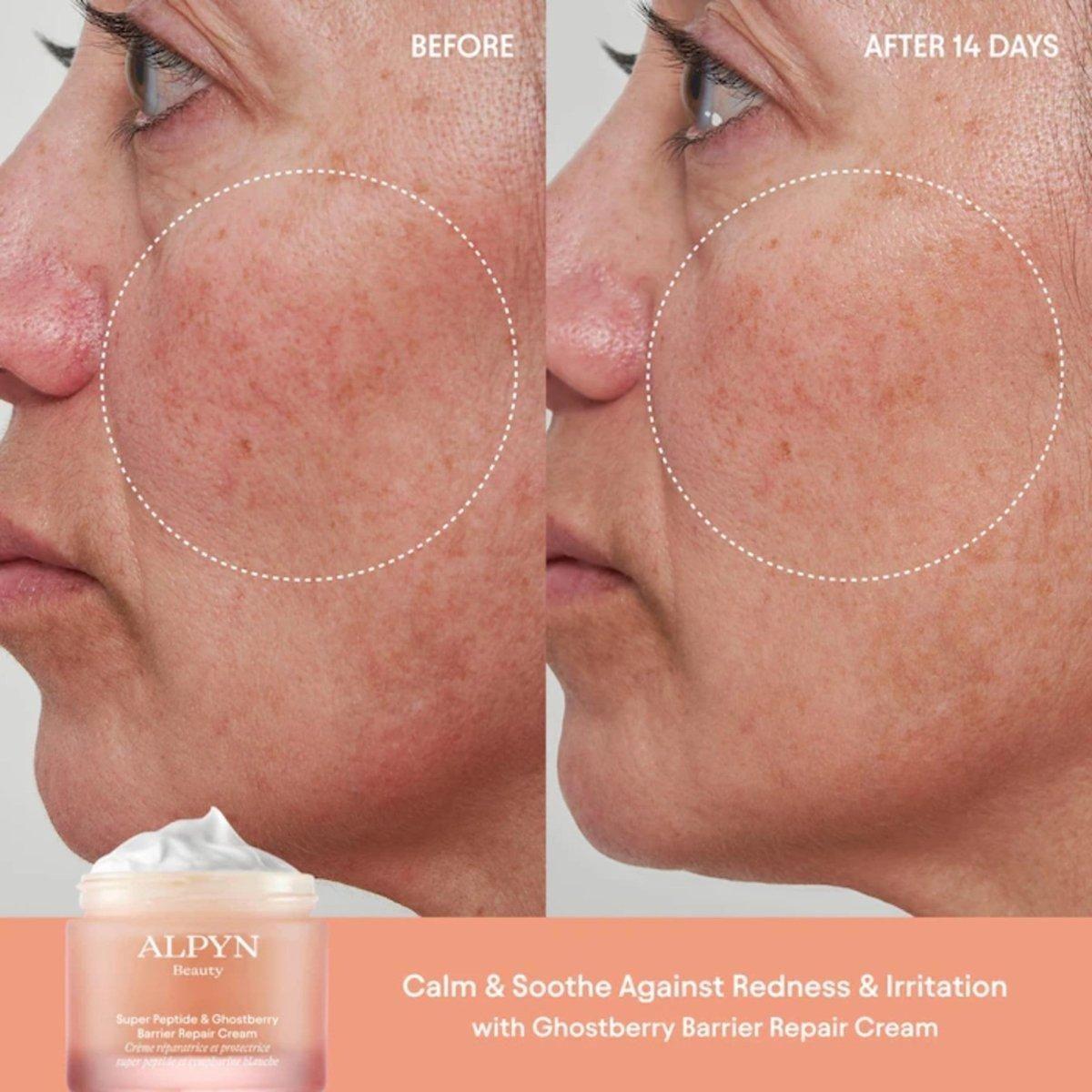 Alpyn Beauty Super Peptide and Ghostberry Barrier Repair Cream - 50ml - Glam Global UKAlpyn Beauty