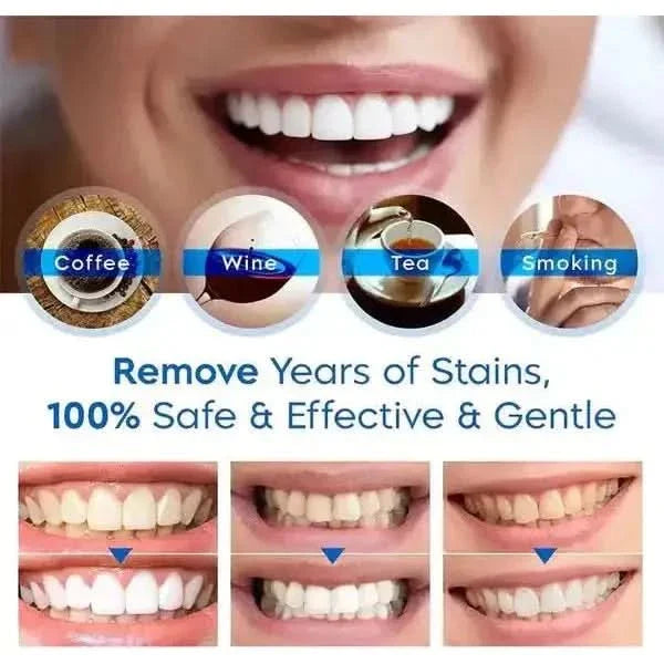 Teeth Whitening Pen – Achieve a Brighter, Radiant Smile Anywhere - Glam Global UKGlam Global UK