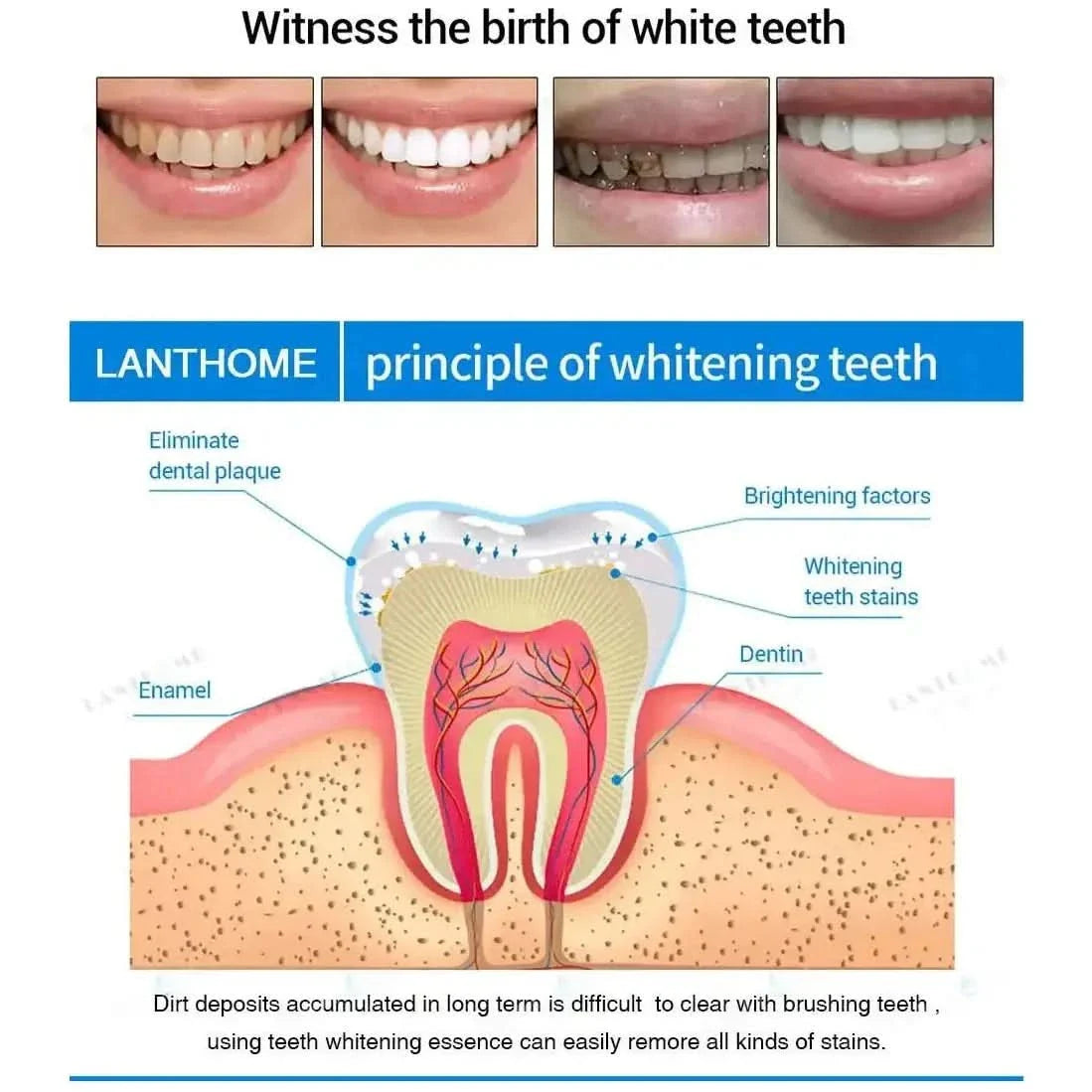 Teeth Whitening Pen – Achieve a Brighter, Radiant Smile Anywhere - Glam Global UKGlam Global UK