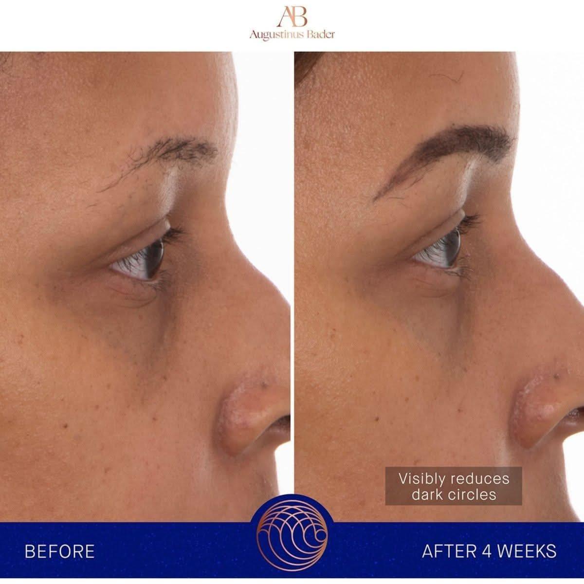Augustinus Bader The Eye Patches | Revitalizing Hydrogel Eye Treatment - Glam Global UKAugustinus Bader
