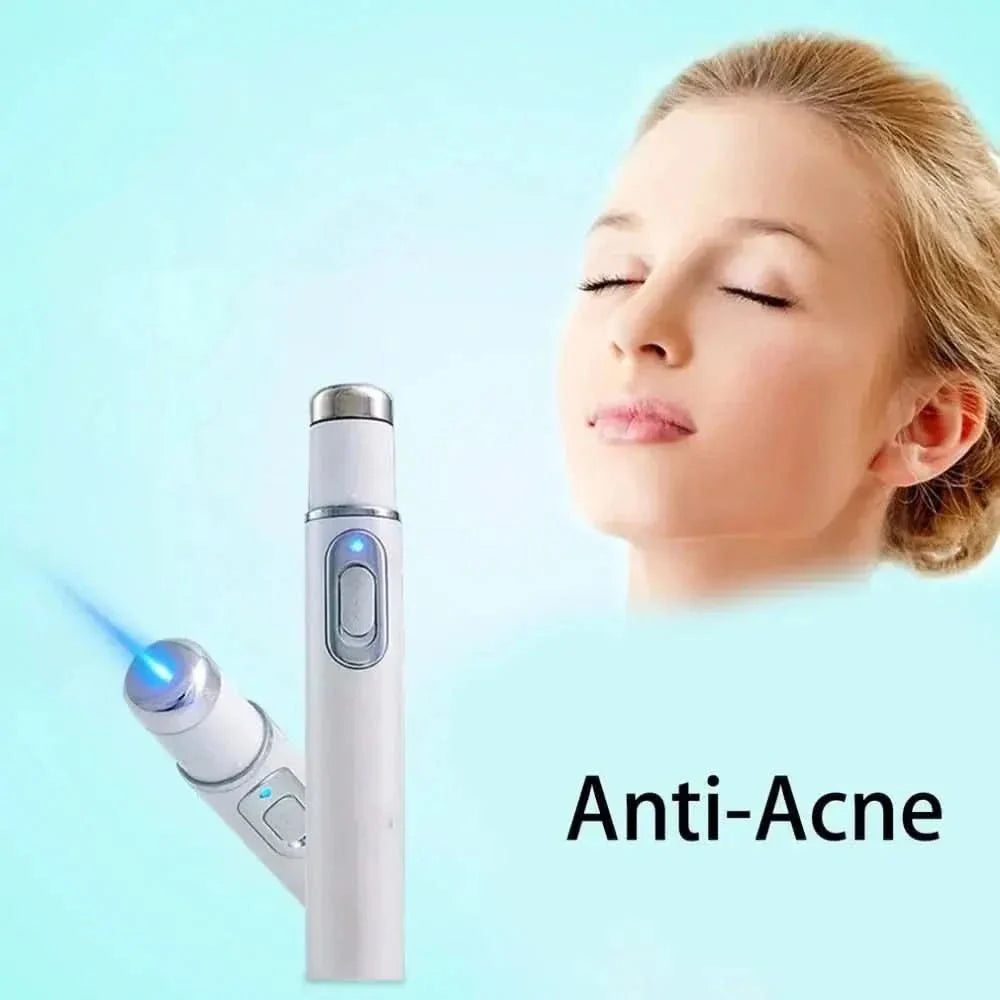 Therapy Acne Laser Pen - Glam Global UKGlam Global UK