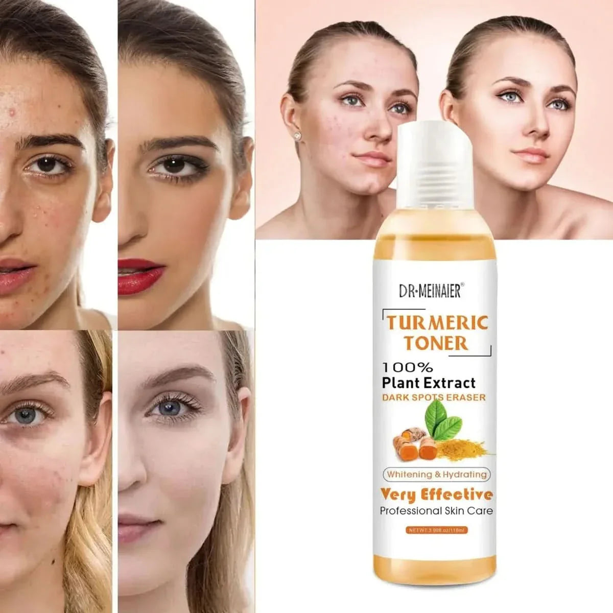 Turmeric Moisturizing Toner - Glam Global UKGlam Global UK