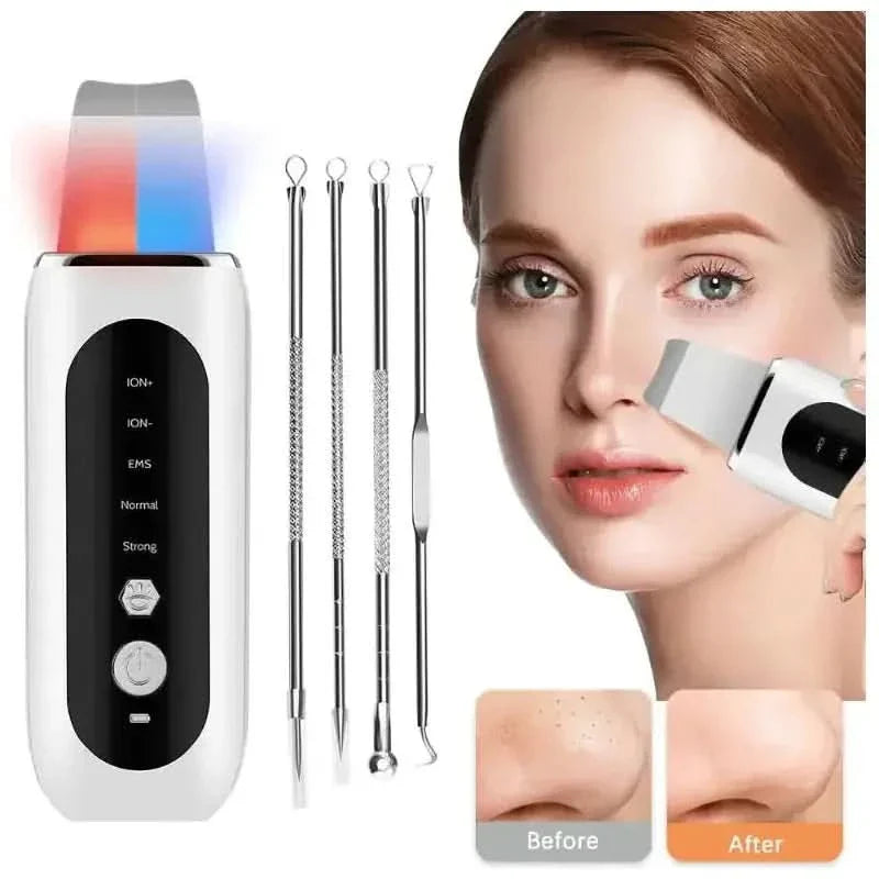 Ultrasonic Face Skin Scrubber – For Radiant, Glowing Skin Every Day - Glam Global UKGlam Global UK