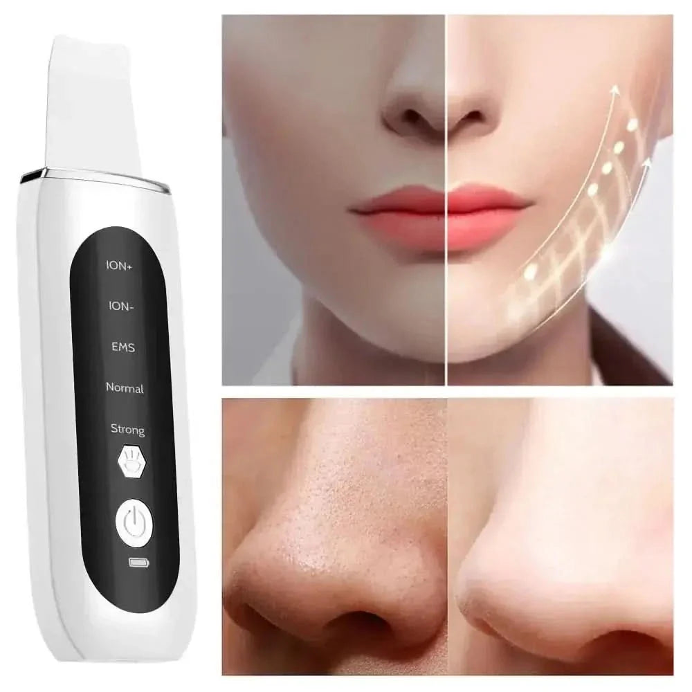 Ultrasonic Face Skin Scrubber – For Radiant, Glowing Skin Every Day - Glam Global UKGlam Global UK