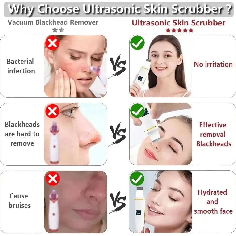 Ultrasonic Skin Scrubber: Professional Facial Cleansing Device - Glam Global UKGlam Global UK