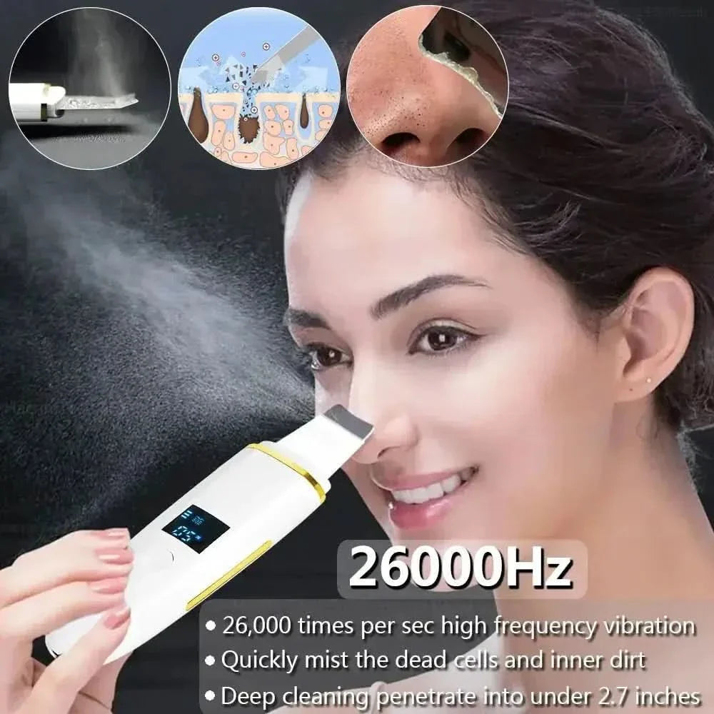 Ultrasonic Skin Scrubber: Professional Facial Cleansing Device - Glam Global UKGlam Global UK