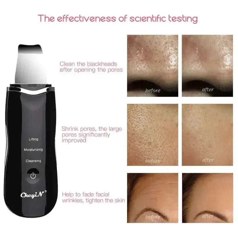 Ultrasonic Skin Scrubber + Skin Rejuvenation Nano Face Mist Steamer - Glam Global UKGlam Global UK