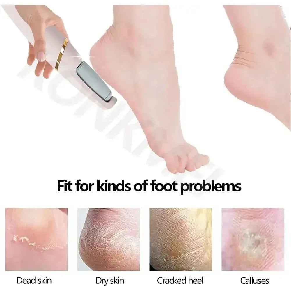 VelvetStep Foot Exfoliator – Smooth, Silky Feet at Home! - Glam Global UKGlam Global UK