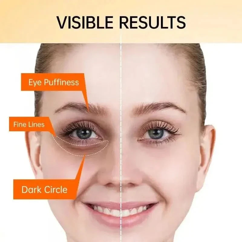 Joy Pretty Vitamin C Brightening Eye Cream – Anti - Dark Circles, Eye Bag & Puffiness Solution - Glam Global UKJoy Pretty