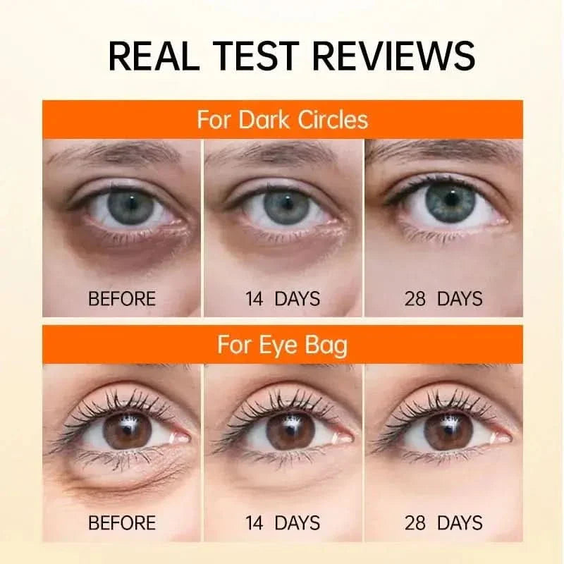 Joy Pretty Vitamin C Brightening Eye Cream – Anti - Dark Circles, Eye Bag & Puffiness Solution - Glam Global UKJoy Pretty