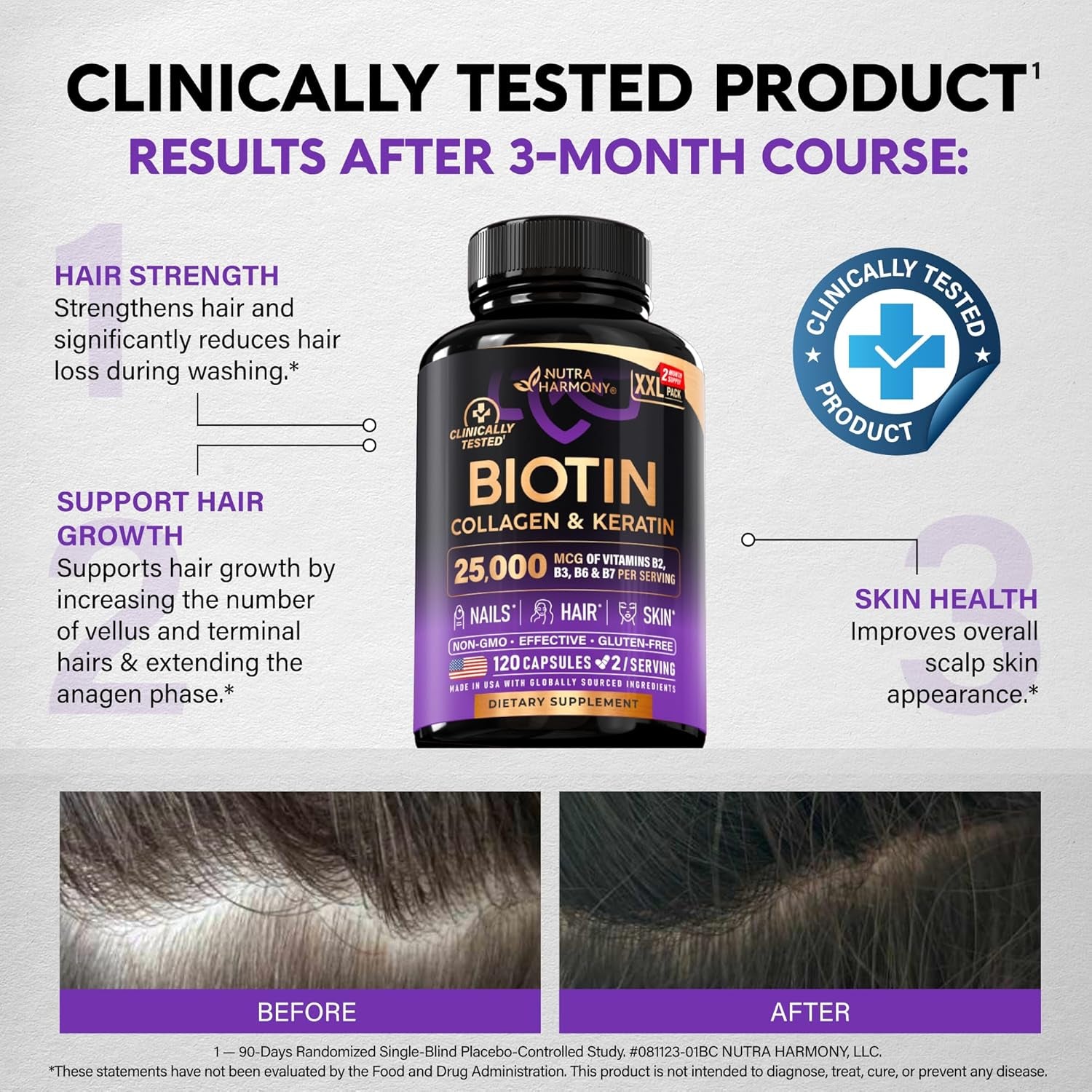 NutraHarmony Biotin, Collagen, Keratin & Hyaluronic Acid Complex – 120 Capsules | 25,000mcg | B Vitamins | Hair Growth, Skin & Nail Support