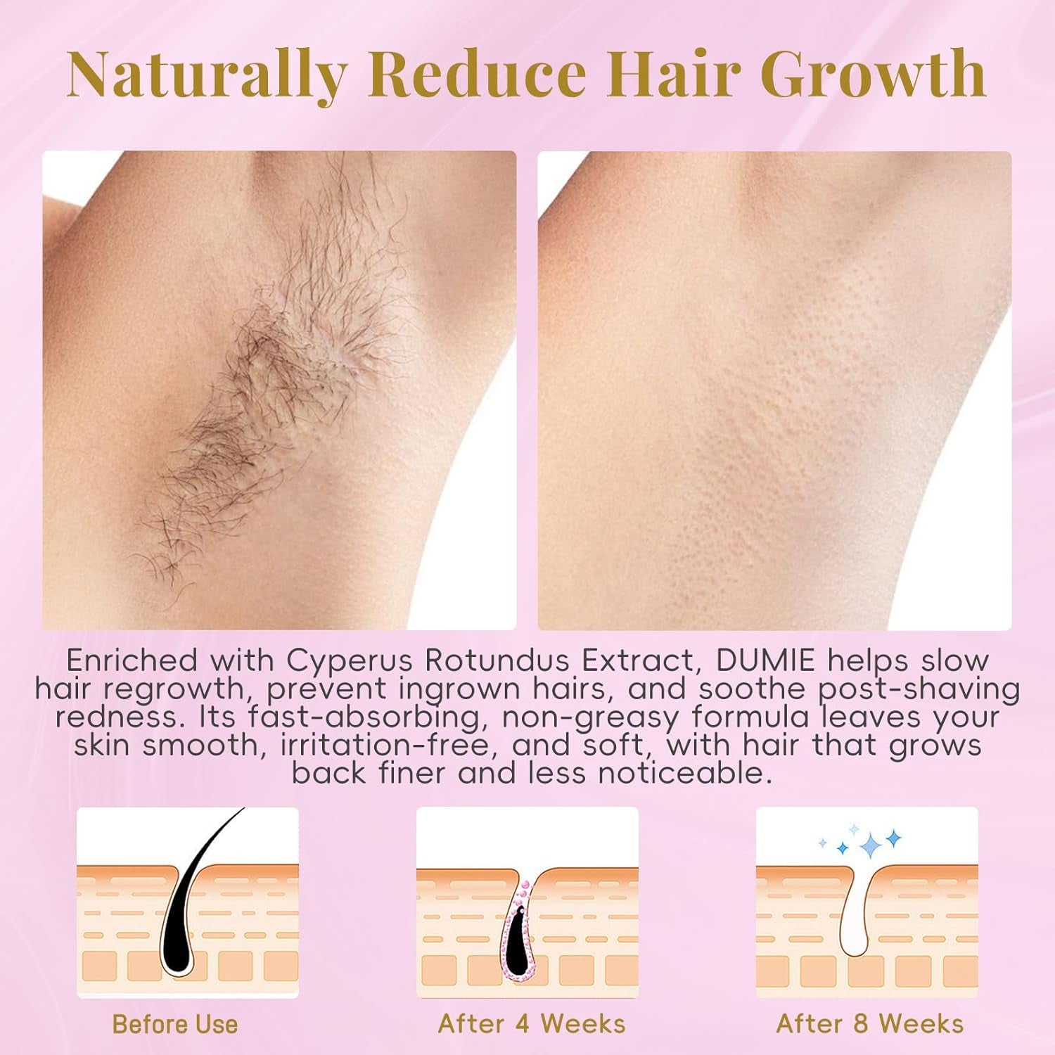Cyperus Rotundus Serum Roll-On – Ingrown Hair & Razor Bump Treatment, Natural Hair Growth Inhibitor & Smoothing Solution for Sensitive Skin, Non-Greasy Post Hair Removal Care（60Ml）