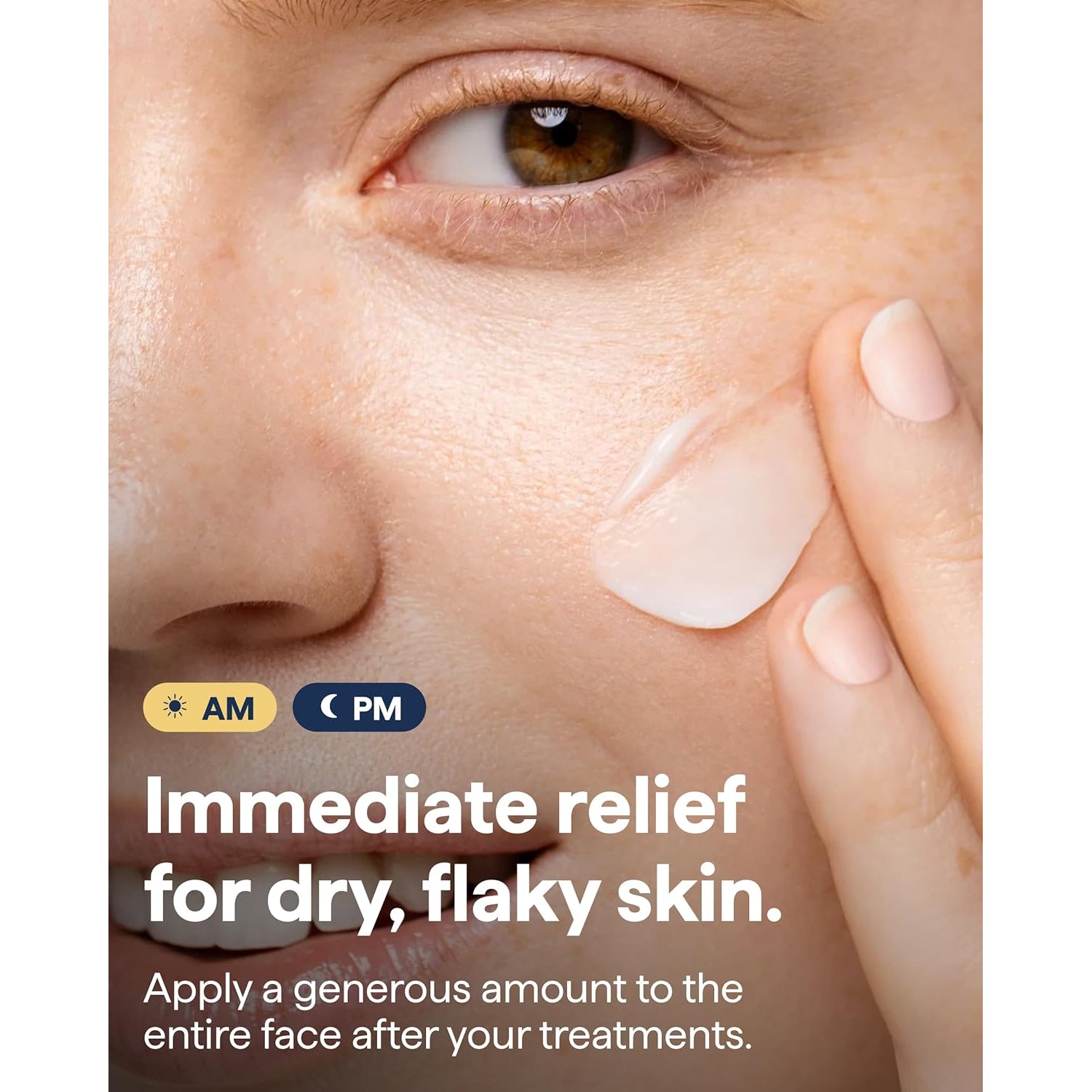 Remedy Rich Barrier Repairing Cream Face Moisturizer - 50ml