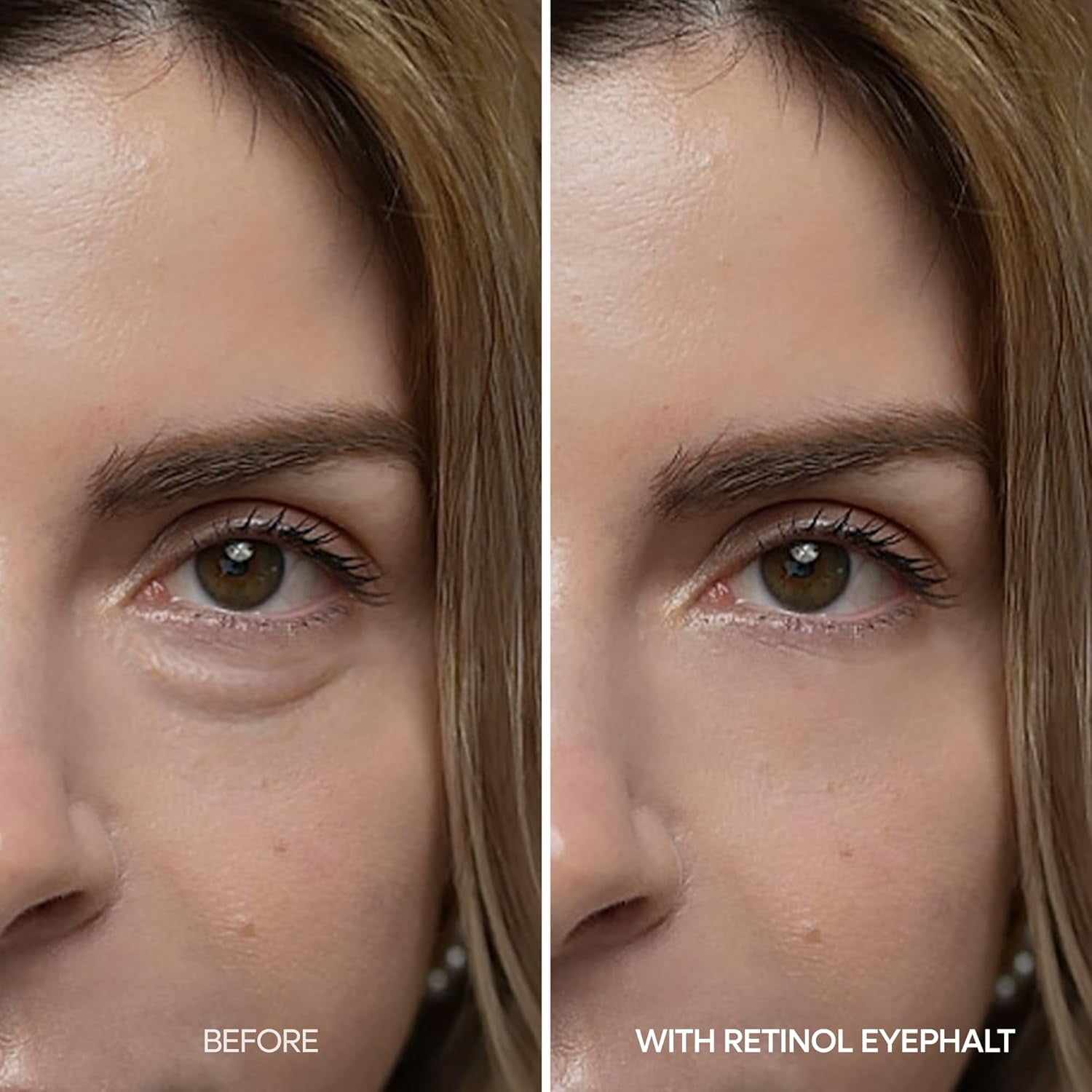 Dr.Melaxin Retinol Eye Bag Cream – EGF, Niacinamide & Ceramide for Dark Circles, Puffiness & Fine Lines | Korean Skincare
