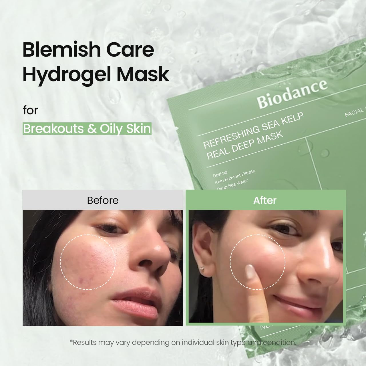 BIODANCE Refreshing Sea Kelp Real Deep Hydrogel Mask – 34g x 4 Sheets | Overnight Hydration | Oil & Sebum Control | Blemish Care & After-Sun Relief
