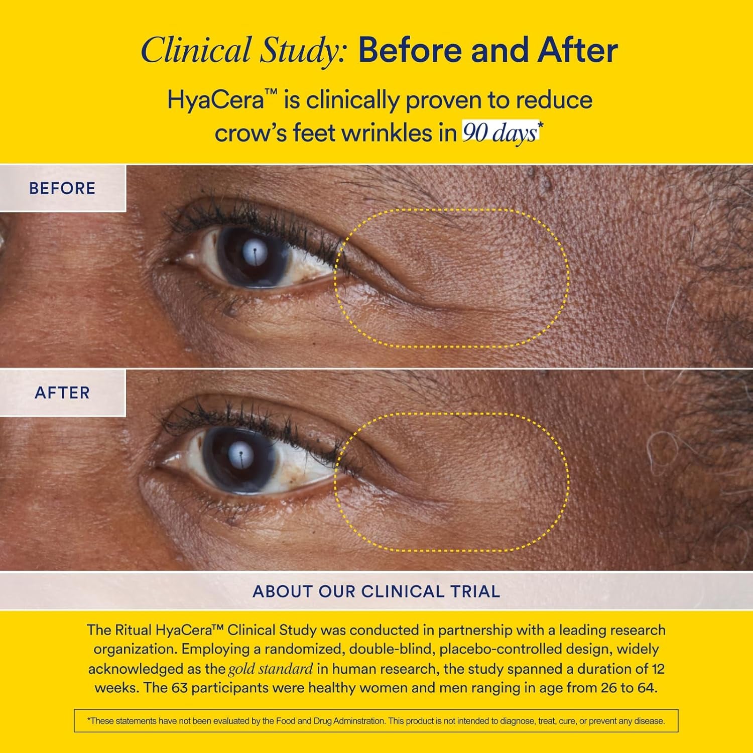 Ritual Hyaluronic Acid Skin Supplement - with Hyabest® and Ceratiq® - Hyacera Clinically Proven to Reduce Wrinkles, Fine Lines & Improve Skin Smoothness** - Vegan - Vanilla - 30 Capsules - 30 Servings