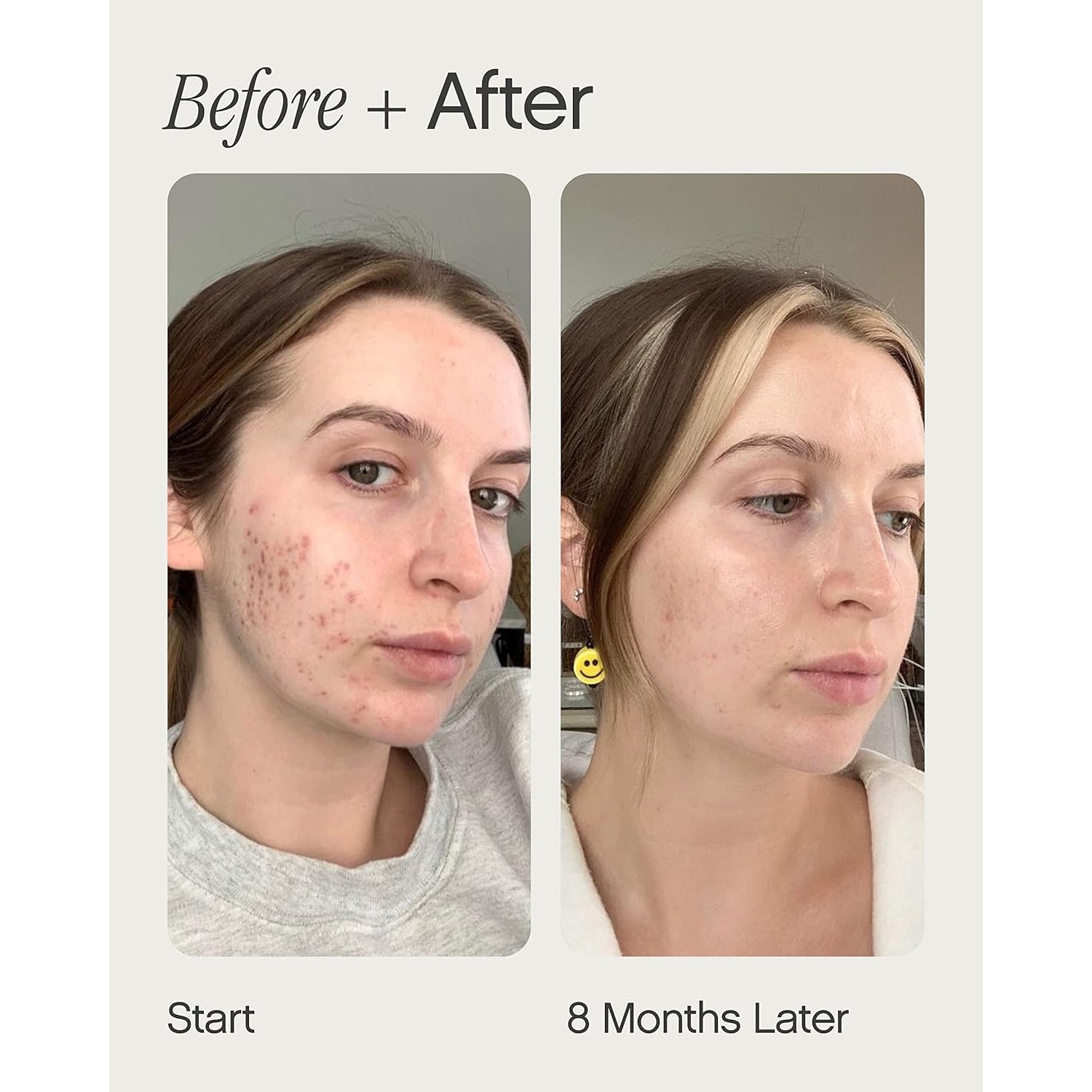 Topicals Faded Brightening and Clearing Serum | Reduces Discoloration, Post-Blemish Marks, Scars and Spots | Contains Kojic Acid and Niacinamide | Dermatologist-Tested, Vegan, Cruelty-Free (0.5 Fl Oz)