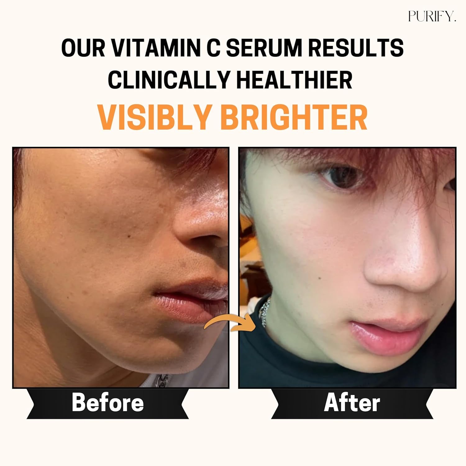 Purify. Vitamin C Serum – 30ml | Brightening, Anti-Aging & Antioxidant Protection with 3-O-Ethyl Ascorbic Acid