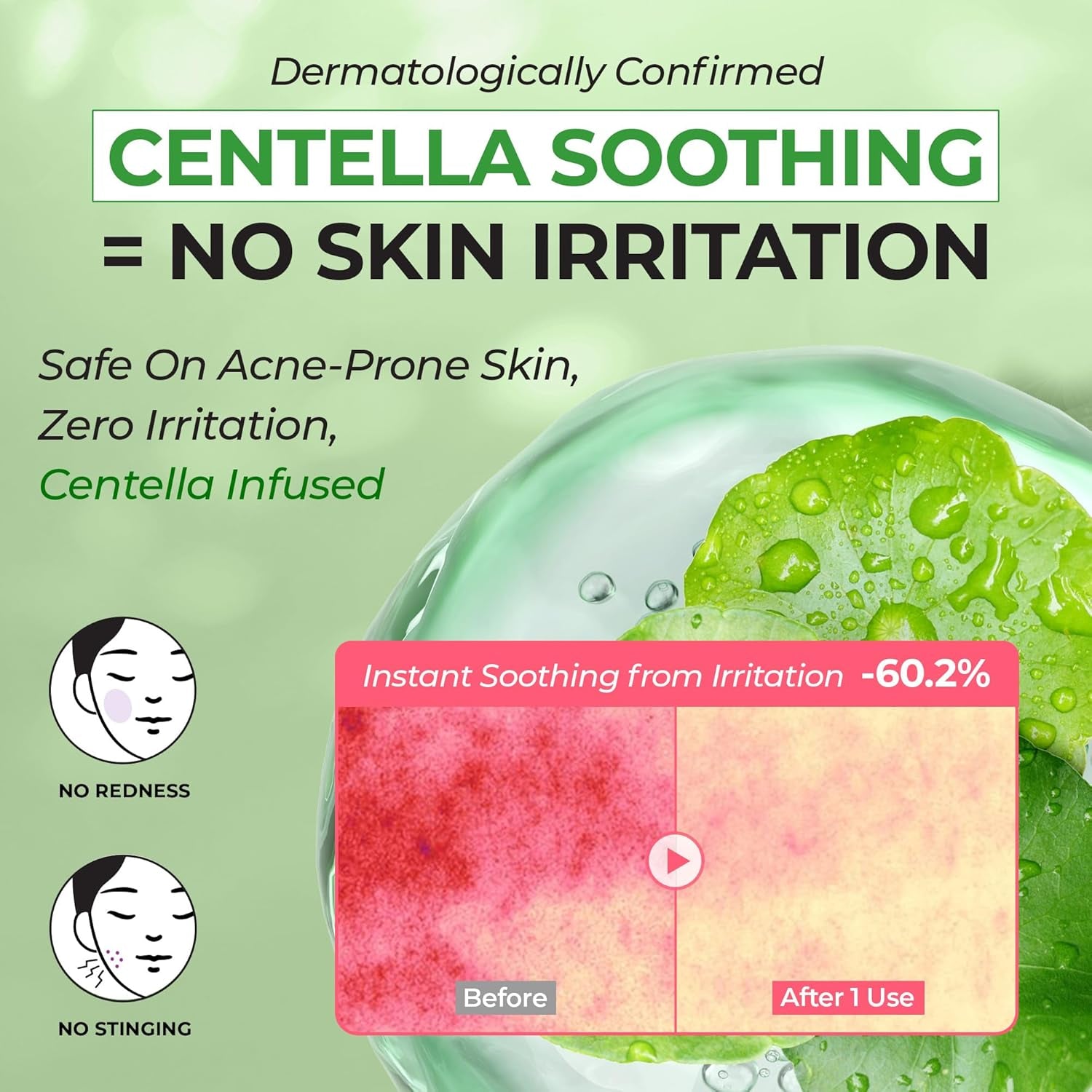 JUMISO Panthenol Ceramide Barrier Repair Cream for Sensitive Skin – 5-Ceramide + D-Panthenol Soothing Gel Moisturizer with Cica, Madecassoside, Squalane, Lightweight, Non-Greasy 2.71 Fl Oz
