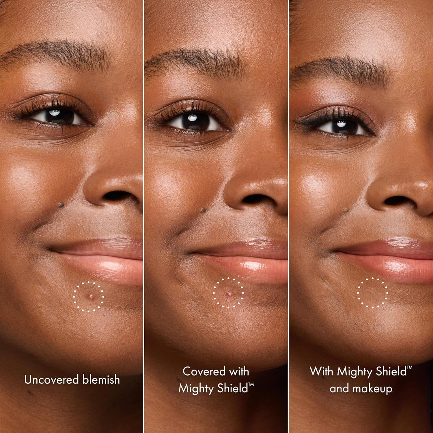 HERO COSMETICS Mighty Shield™ Liquid Patch Invisible Blemish Protectant for Pimples, Zits, and Blemish Wounds. Fast-Drying and Protects Blemishes from Makeup, Sunscreen
