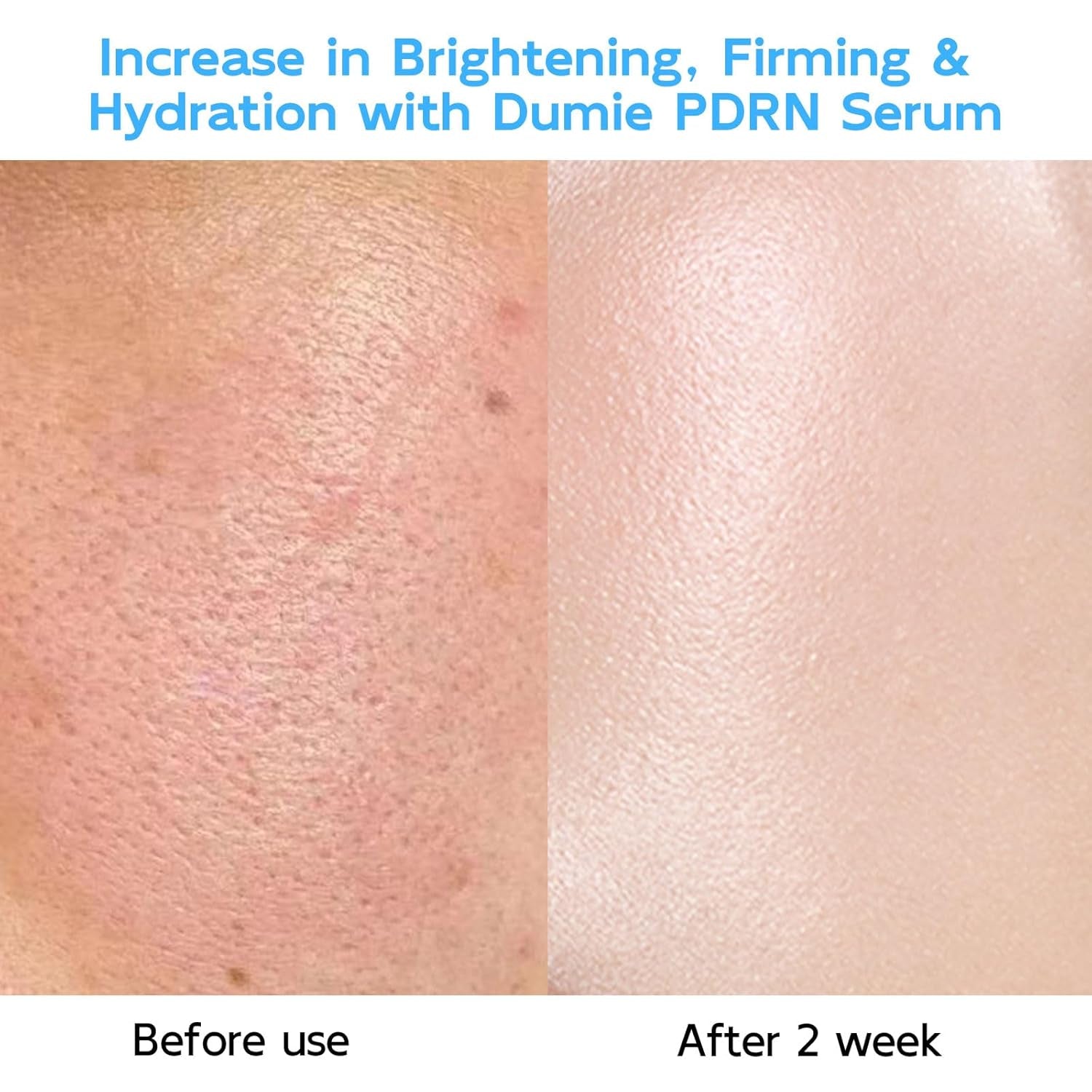 Salmon DNA PDRN Anti-Aging Serum, 5000Ppm Salmon Egg DNA Ampoule, 2000Ppm Collagen, Glutathione, Niacinamide & 6 Hyaluronic Acids, Korean Skincare for Wrinkles & Radiance,0.05 Fl.Oz X 30E