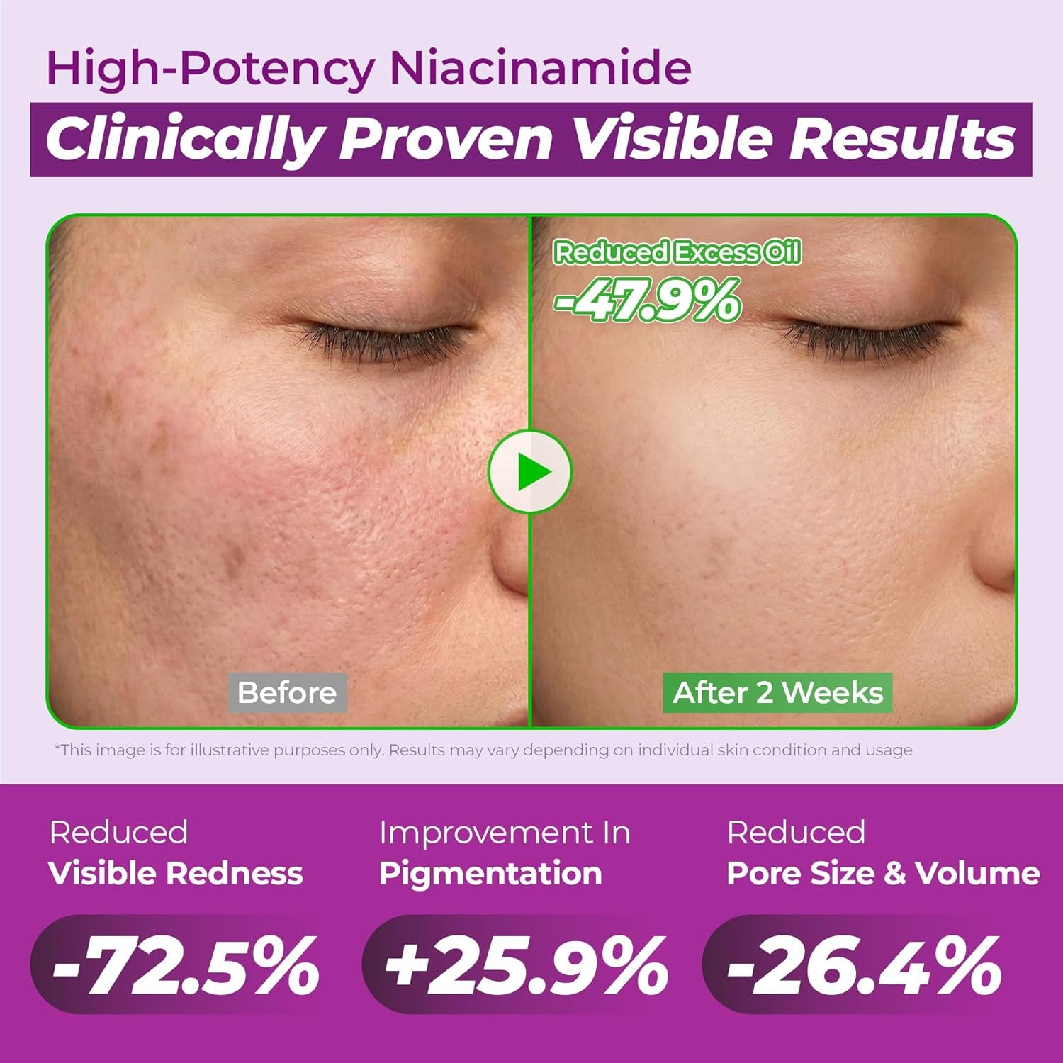 JUMISO 10% Niacinamide Dark Spot Serum – TXA + Glutathione Brightening Face Serum for Daily Use – No Pilling Water-Gel, Helps Even Skin Tone – Centella Soothing, Beginner-Friendly, 1.35 Fl Oz