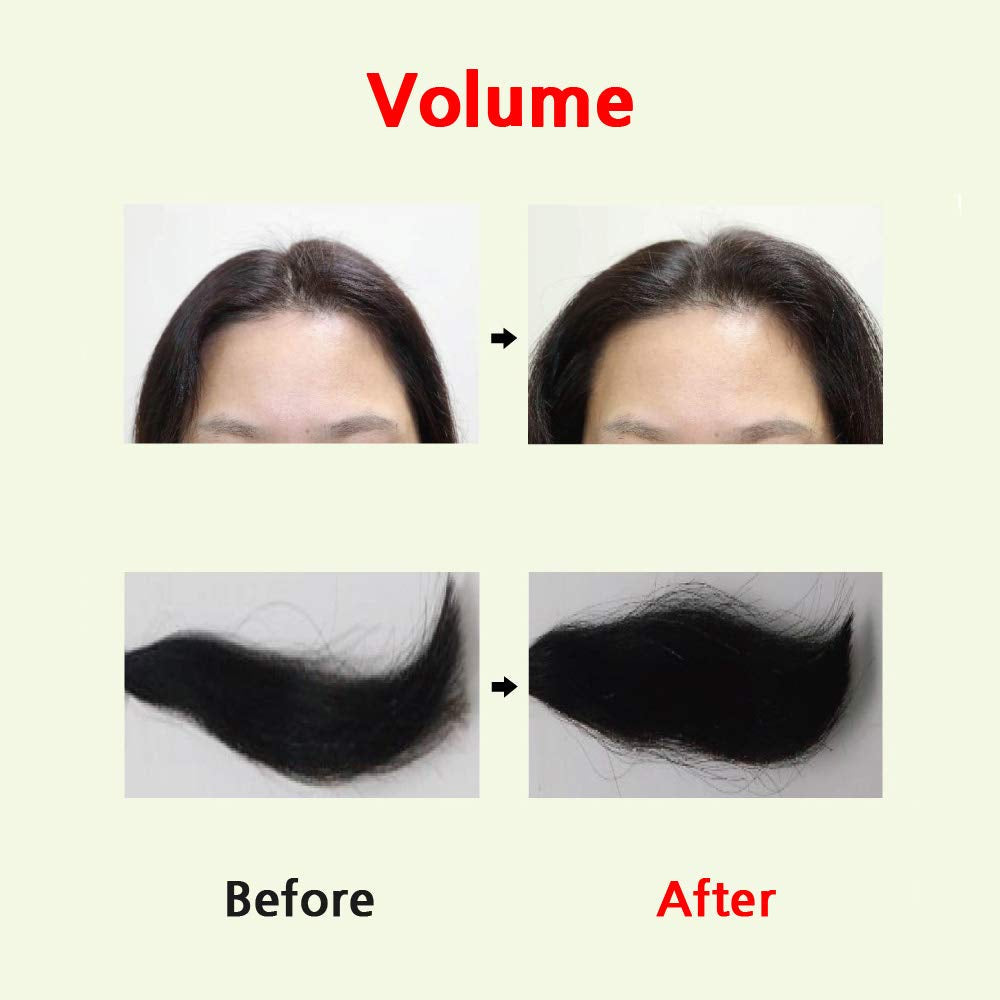 CH6 Scalp SSAG Serum – 140ml | Hair Loss Relief & Thicker, Fuller Hair for All Hair Types