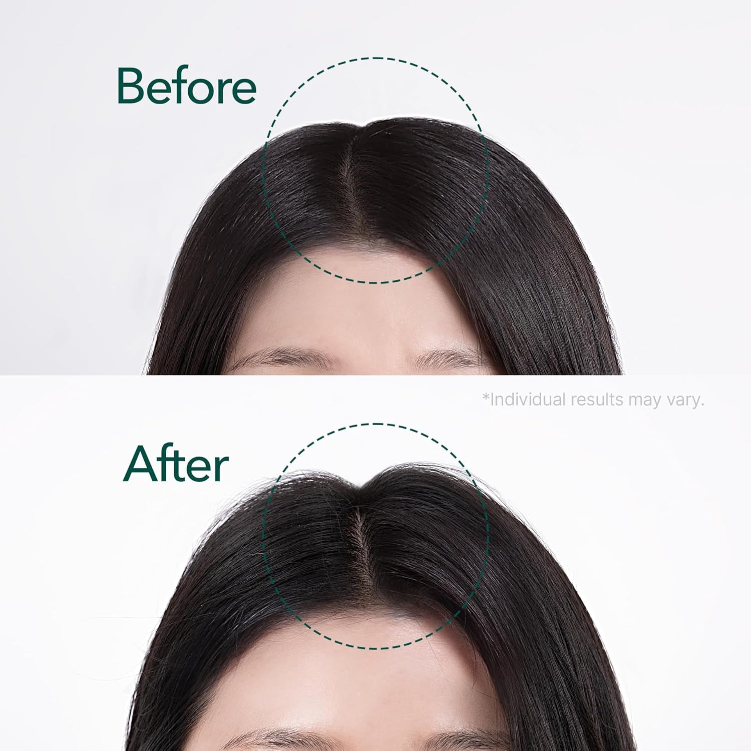Vivelab Rosemary & Multi-Peptide Hair Growth Serum - Targeted Roll on Scalp Treatment for Thicker Hair Density, Clinically Tested for Healthier Hairline & Brows