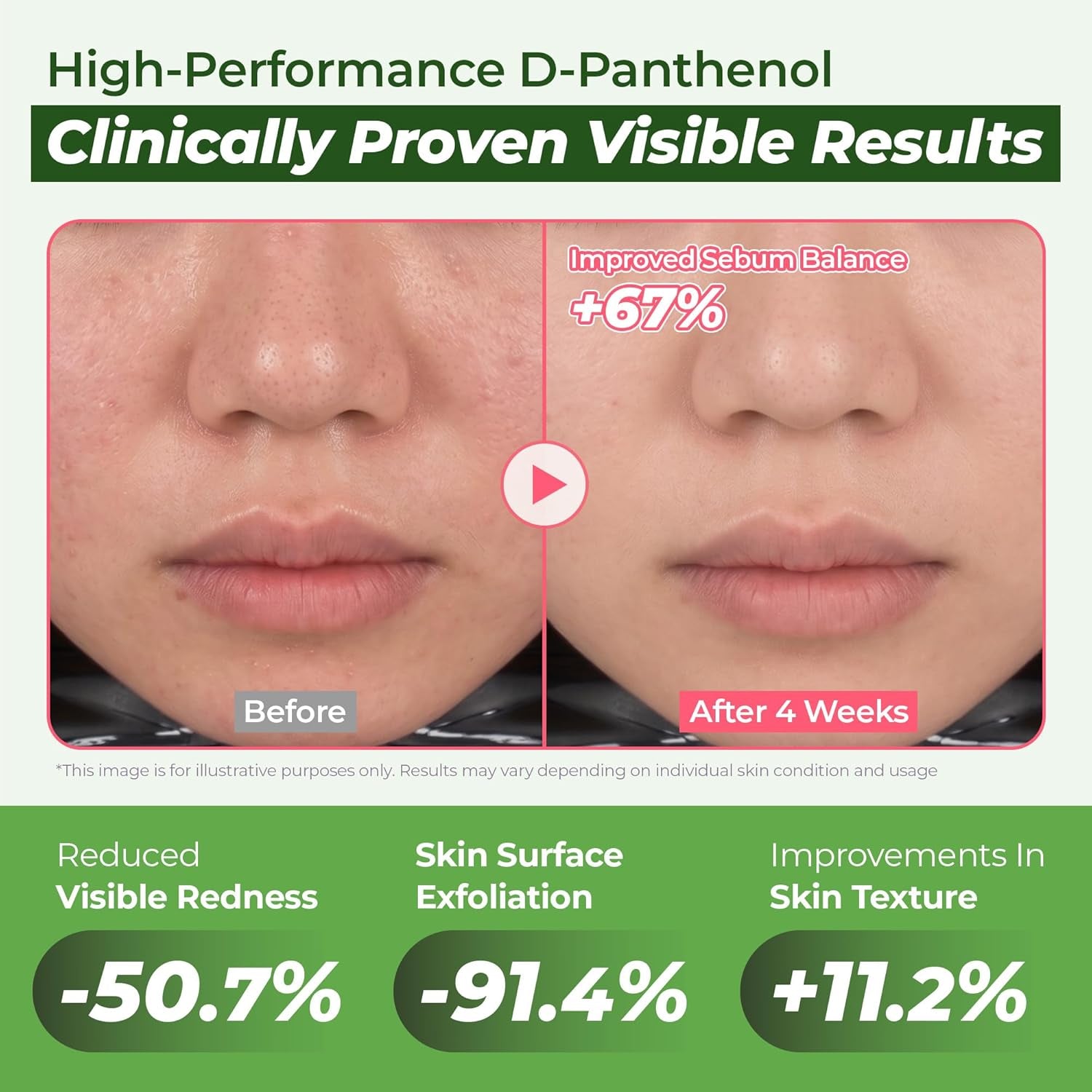 JUMISO D-Panthenol Hydrating Serum – 10 Types Hyaluronic Acid for Oily Dehydrated Sensitive Skin – Cooling Watery Texture, Non-Sticky, BHA + Niacinamide Pore Care – Fragrance-Free, Jumbo 2.37 Fl Oz