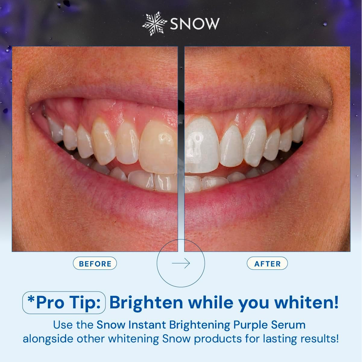 SNOW Teeth Brightening Purple Serum | Gentle & Enamel Safe Instant Brightening for Brighter Smile | Dental Care, Hygiene, & Tooth Care Bright Smile for Events Daily Confidence 2 Month Supply