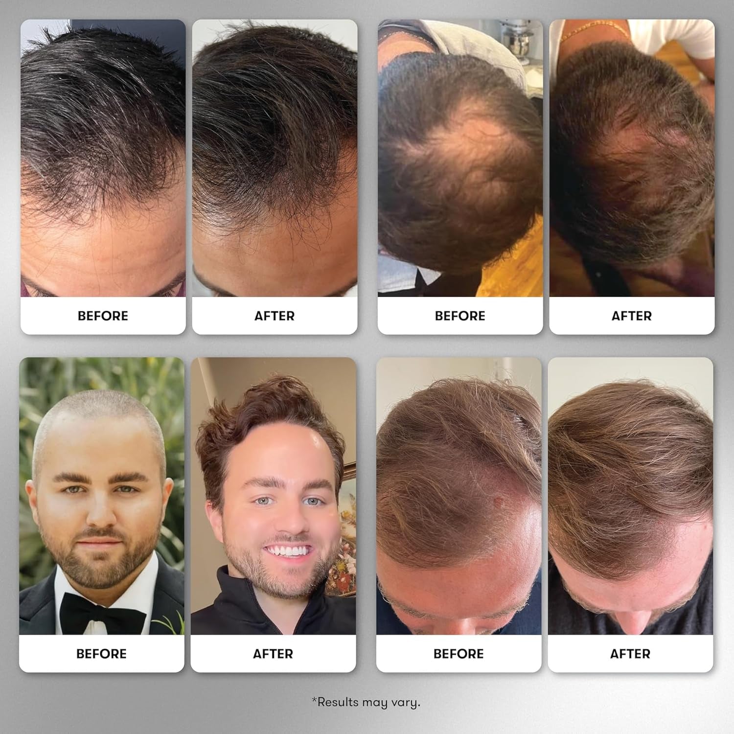 WELLBEL Men Clean Hair Supplement – 90 Capsules | Drug-Free Daily Formula to Support Hair Growth & Thickness