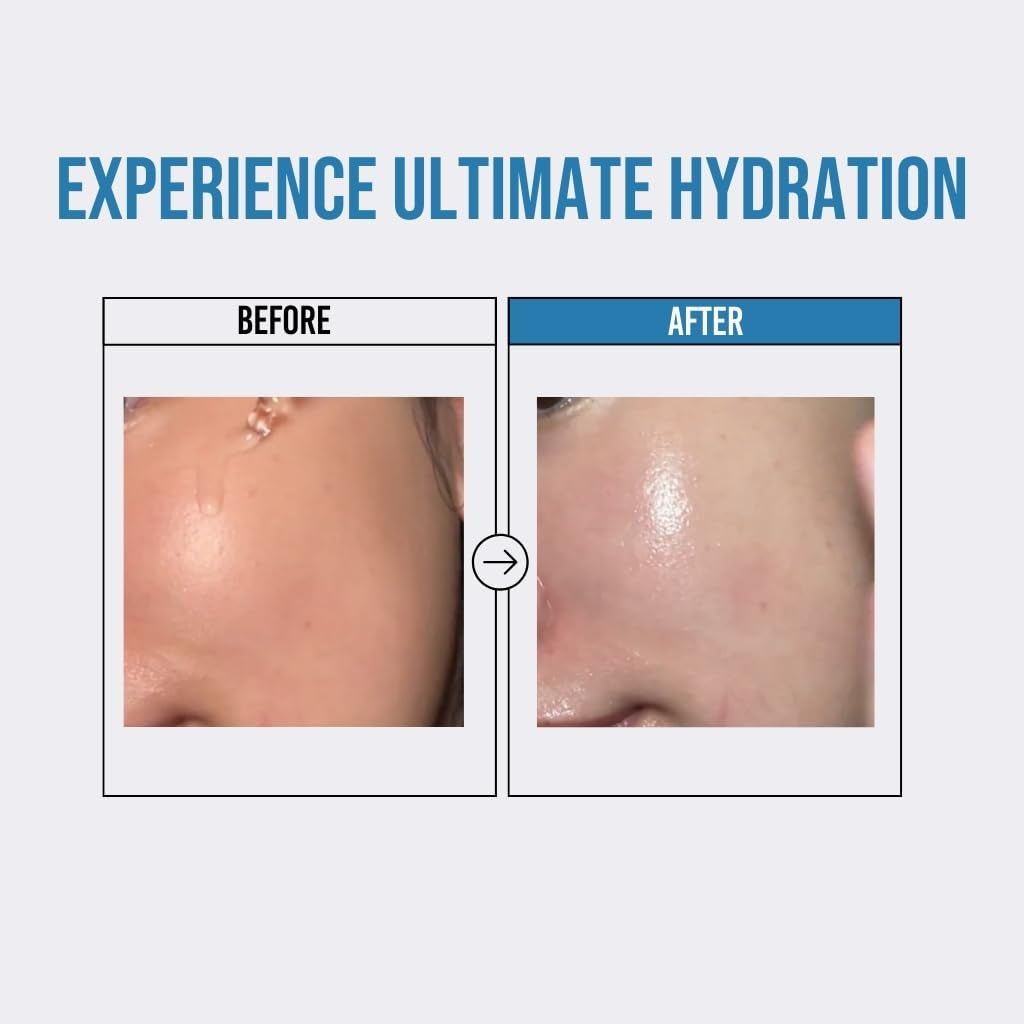 Jumiso Waterfull Hyaluronic Acid Serum 1.69 Fl.Oz / 50Ml | Face Moisturizer, Facial Hydrating Serum for All Skin Types, Moisture Booster for Dry Skin | Vegan, Fragrance-Free