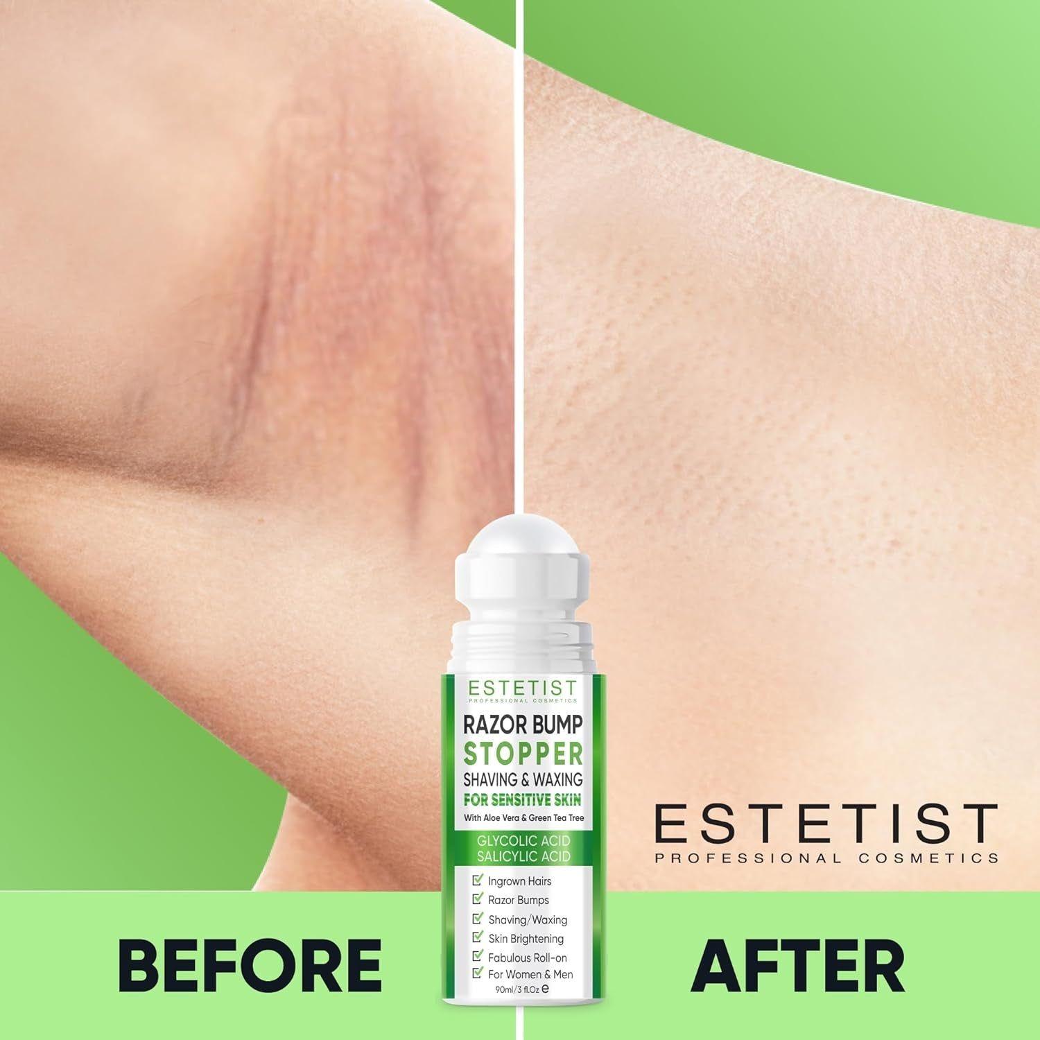ESTETIST Razor Bump Stopper (Citrus Scent) – 90ml | Ingrown Hair & Razor Burn Solution for Sensitive Skin