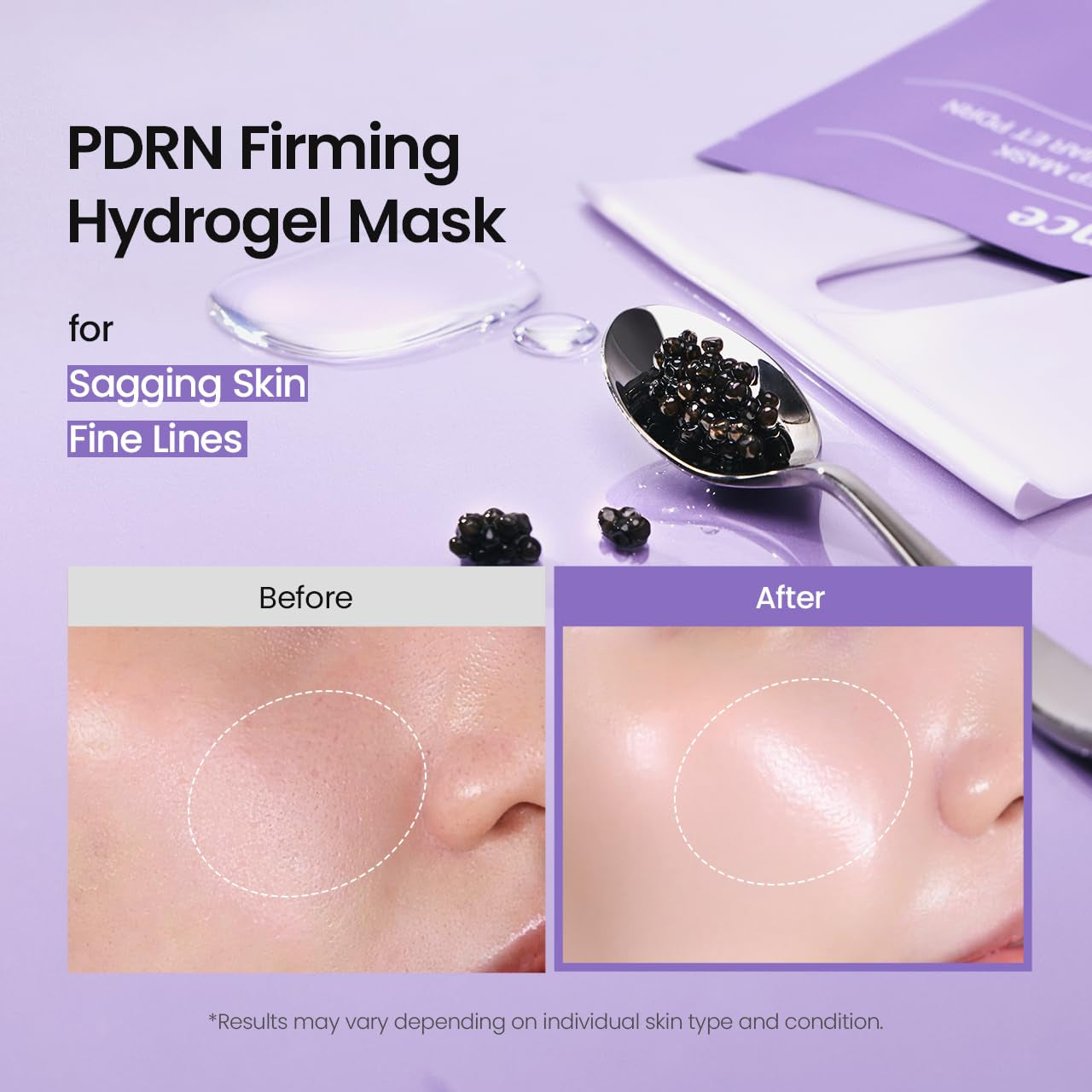 BIODANCE Rejuvenating Caviar PDRN Real Deep Hydrogel Mask – 34g x 4 Sheets | Overnight Skin Firming, Radiance & Recovery | Korean Skincare