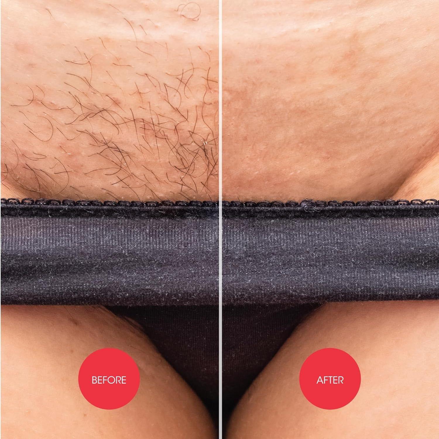 Nad’s Down Under Hair Removal Cream – 150ml | Gentle & Painless Intimate Hair Removal